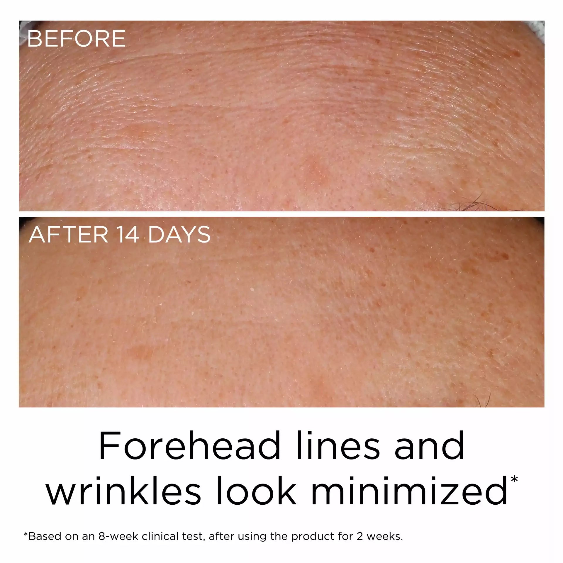 PREVAGEĀ® Anti-Aging Daily Serum 2.0 - Image 8