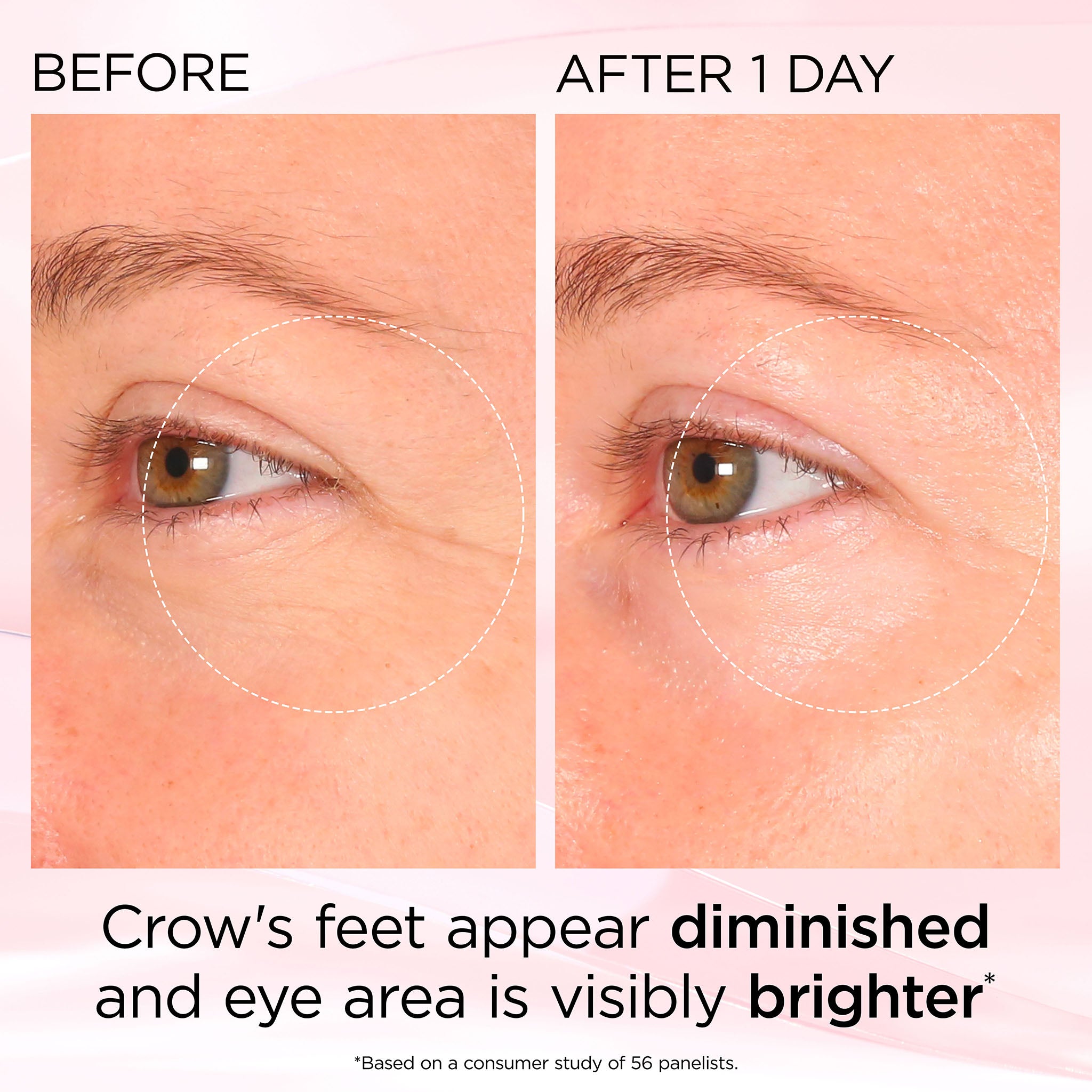 Retinol + HPR Ceramide Rapid Skin Renewing Eye Cream - Image 12