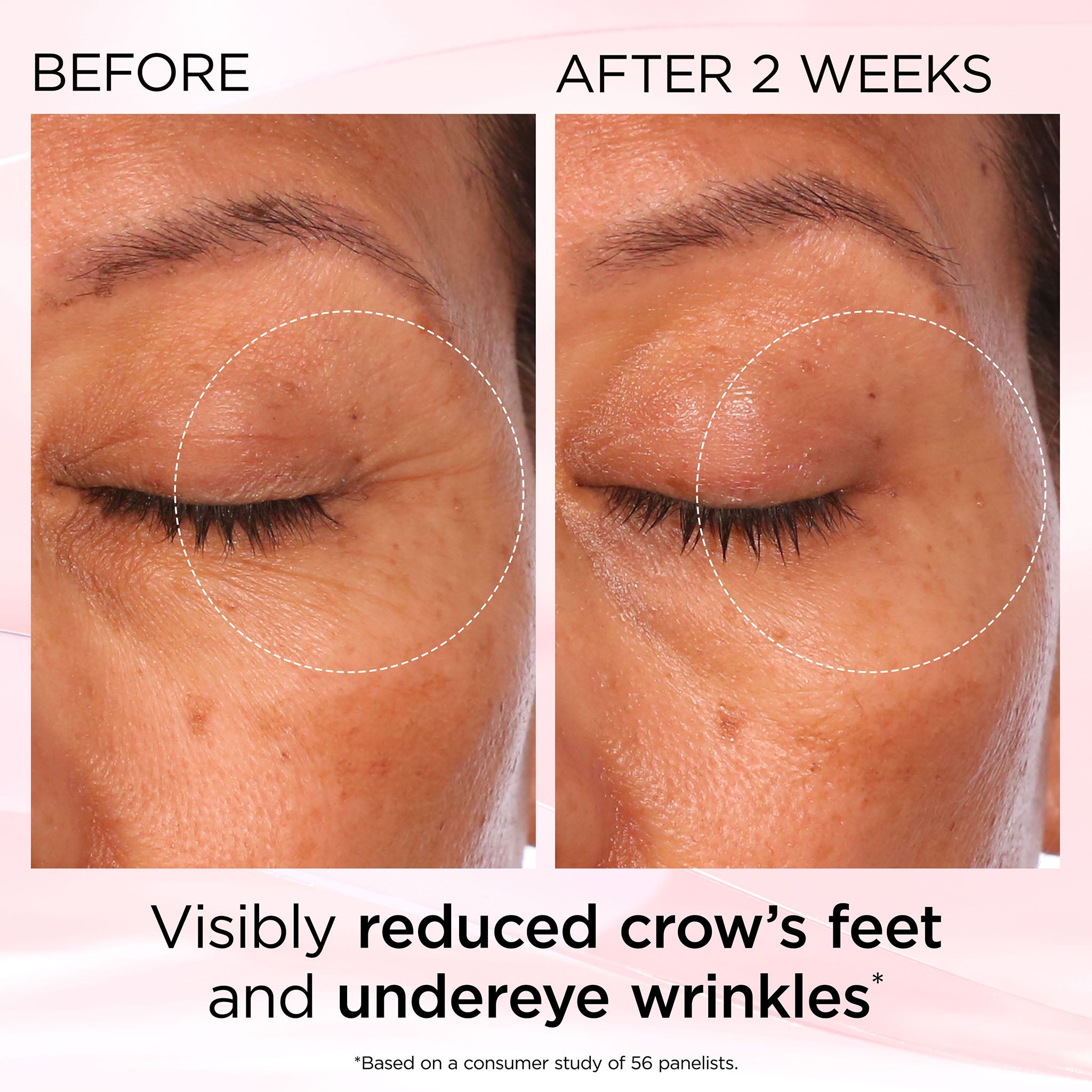Retinol + HPR Ceramide Rapid Skin Renewing Eye Cream - Image 11
